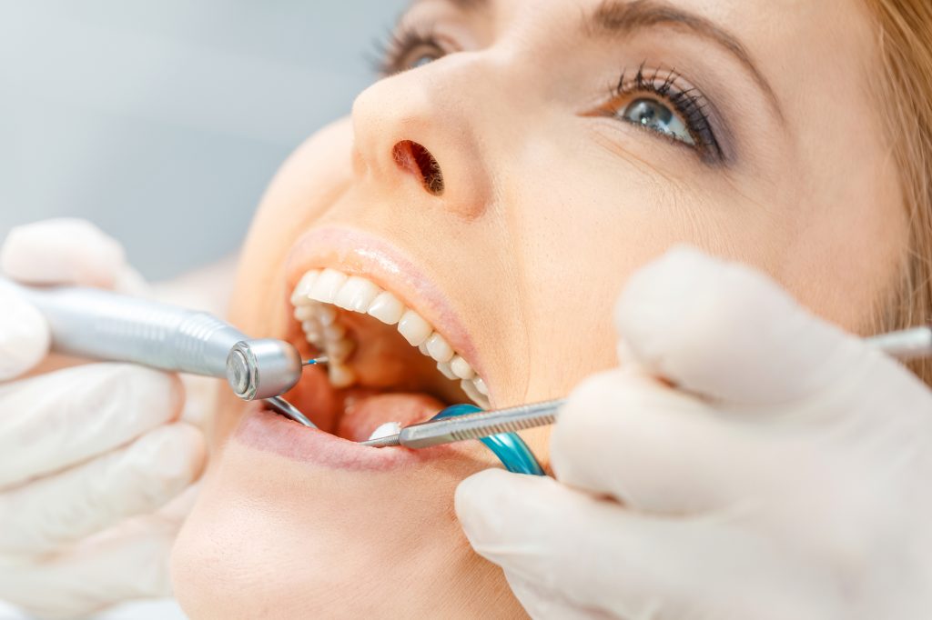 What are the benefits of a tooth crown in Doral?