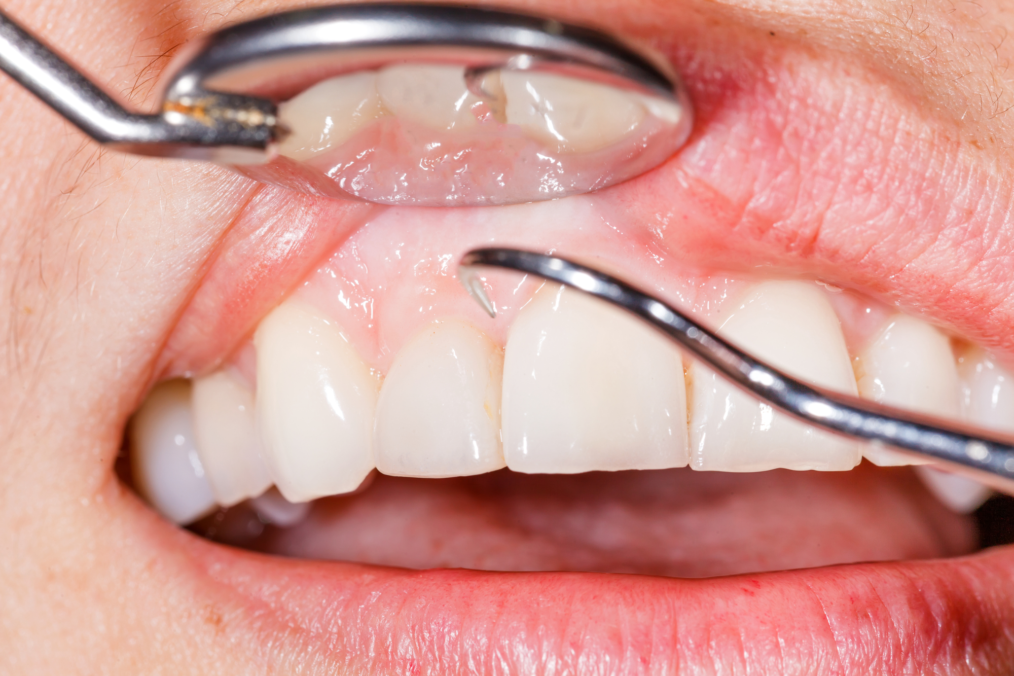 When should I see my ADDP dentist in Doral?